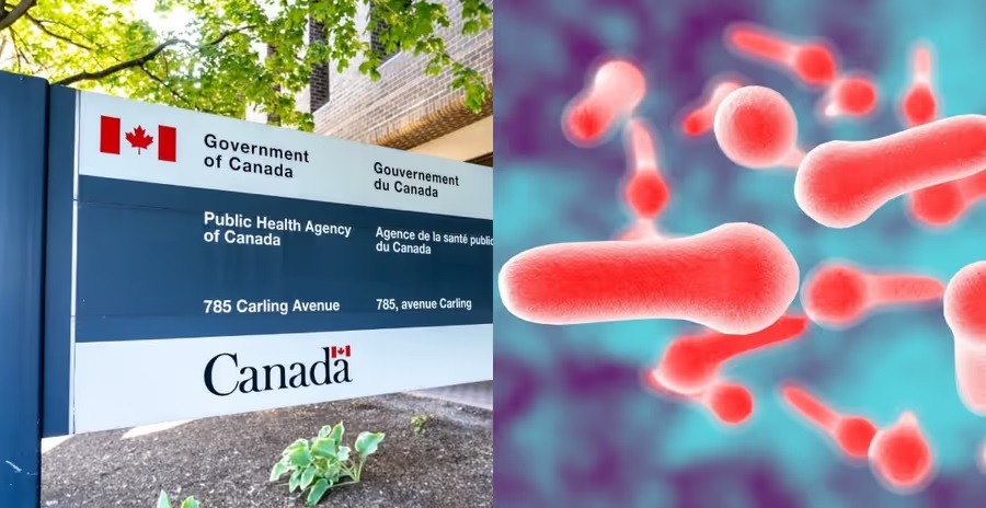 Agência de Saúde Pública do Canadá investiga suspeita de surto de botulismo; saiba mais