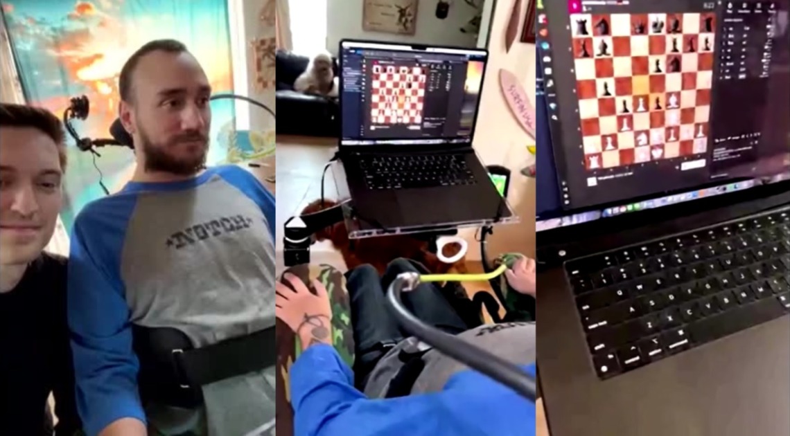(Vídeo) Empresa de Elon Musk mostra 1º paciente com chip cerebral jogando xadrez com a mente